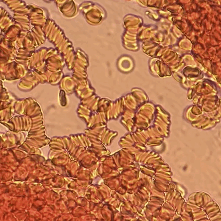 Red blood cell