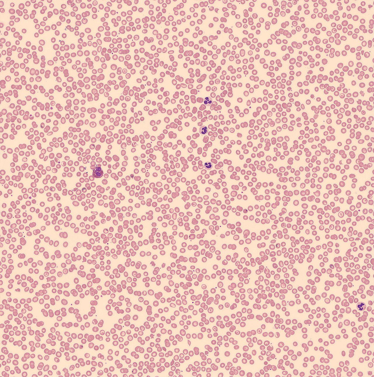 Red blood cell