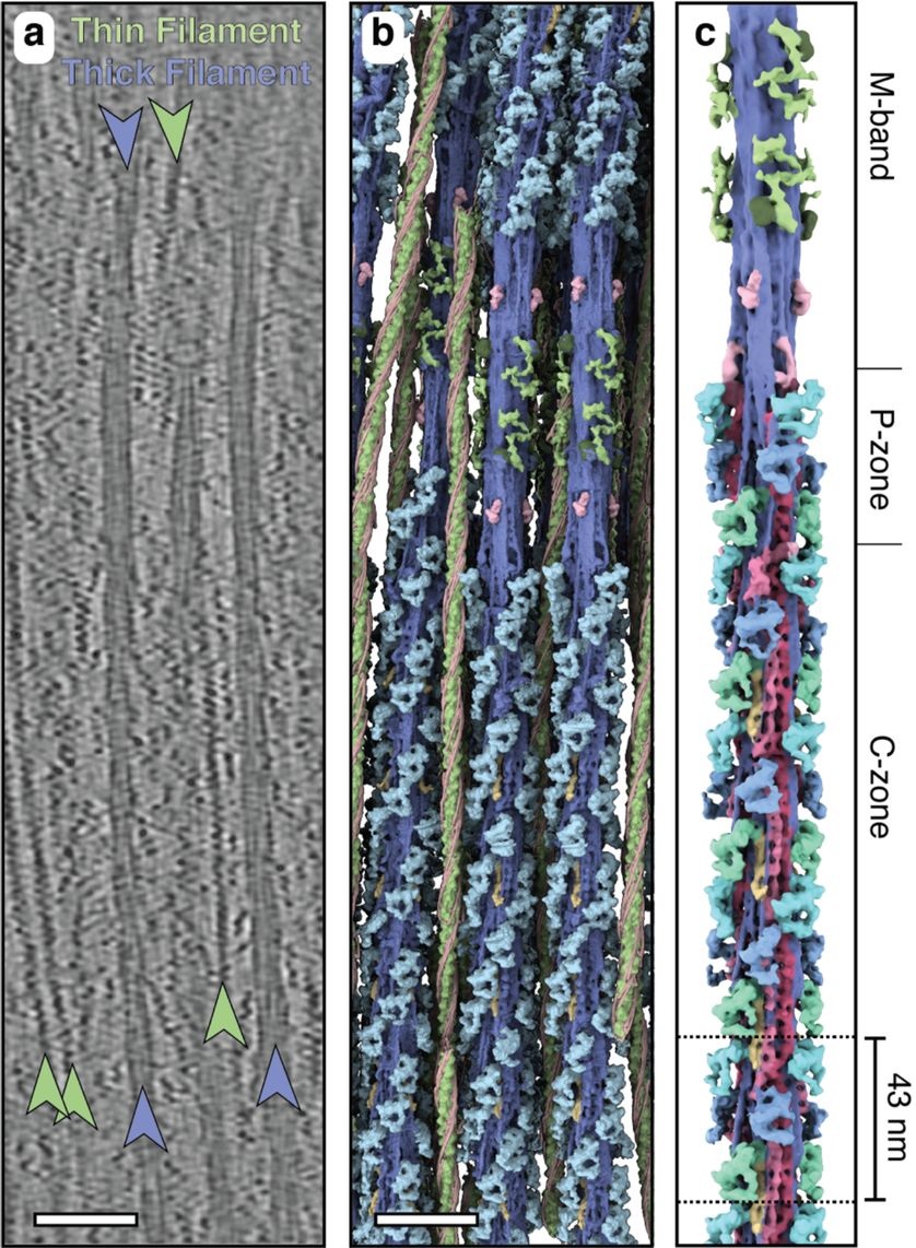 Sarcomere